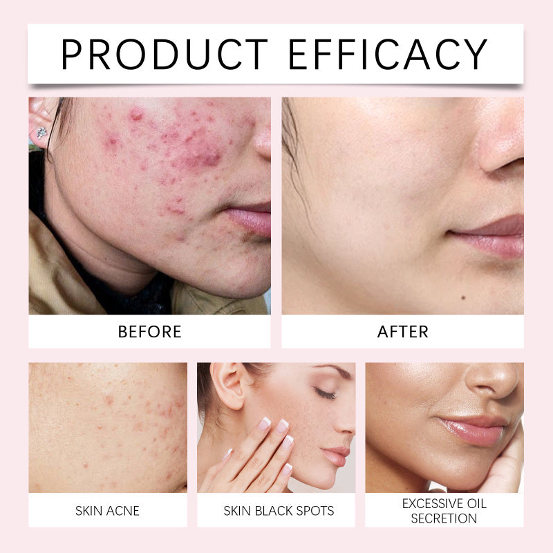 “Pads limpiadores con ácido kójico y cúrcuma — piel luminosa y uniforme.”